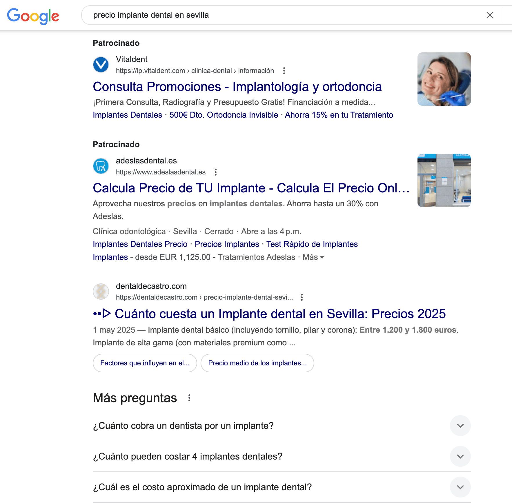 Precio implante dental en Sevilla Precio implante dental en Sevilla